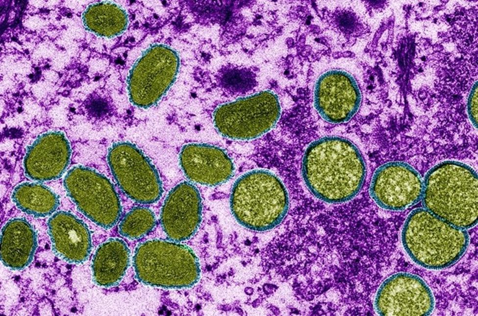 Hình 1: MPXP dưới kính hiển vi điện tử có màu (Nguồn: CDC/CYNTHIA S.GOLDSMITH)